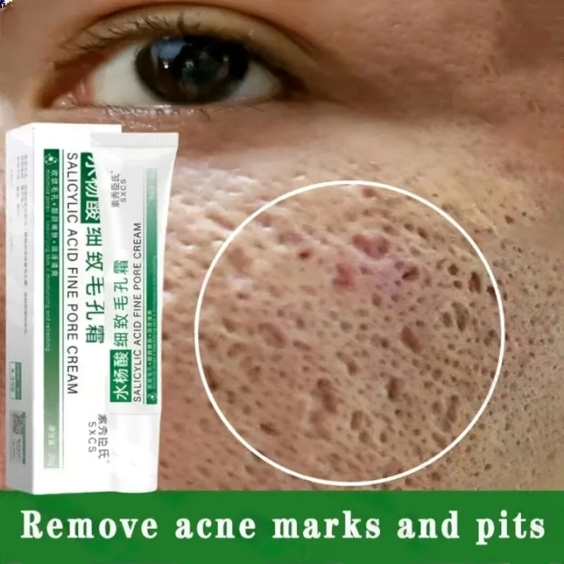 Skincare Salicylic Acid - Crème de nettoyage des pores à