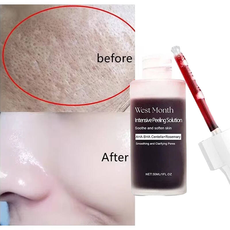 Tranexamic Acid Serum - Se sent comme du soie, a