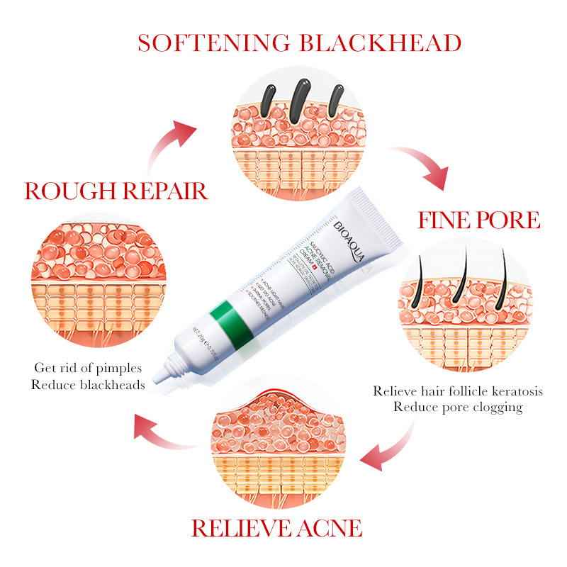 1/2/3 pièces BIOAQUA acide sal - Skincare Salicylic Acid avis et prix