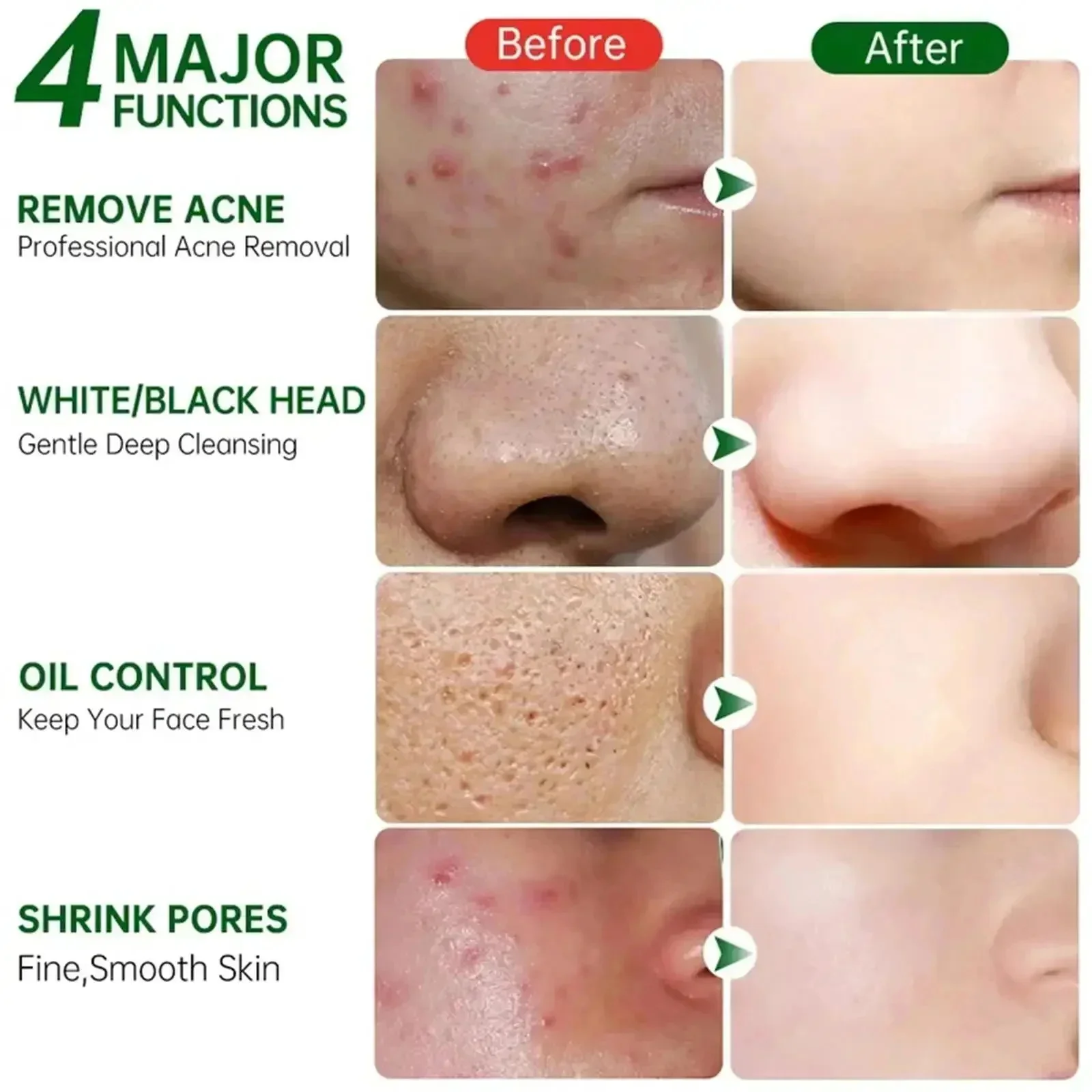 Crème de nettoyage des pores à - Skincare Salicylic Acid avis et prix
