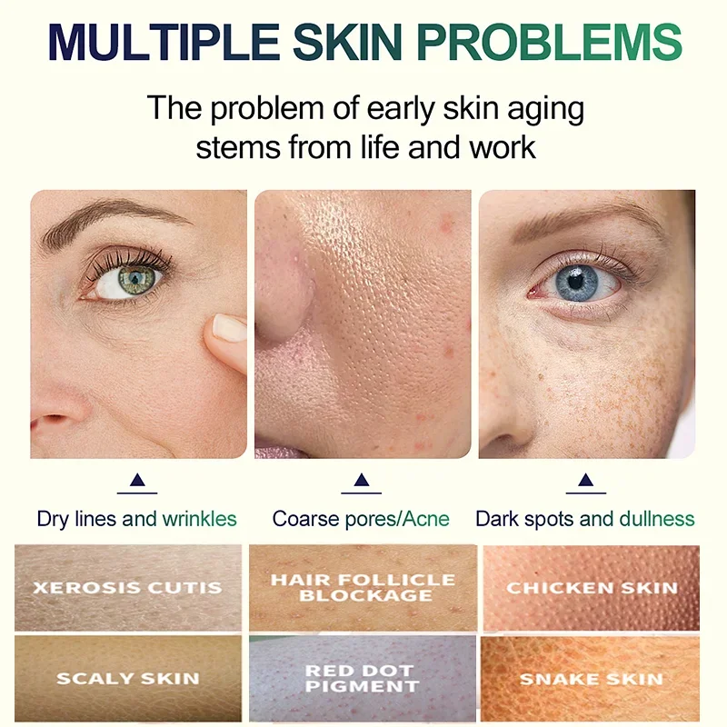 2ème Génération Sérum Exfolian - Tranexamic Acid Serum avis et prix