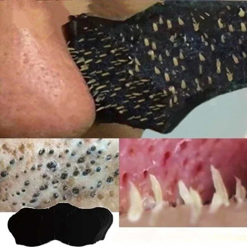 Masque unisexe pour éliminer l - Skincare Viral Tiktok avis et prix