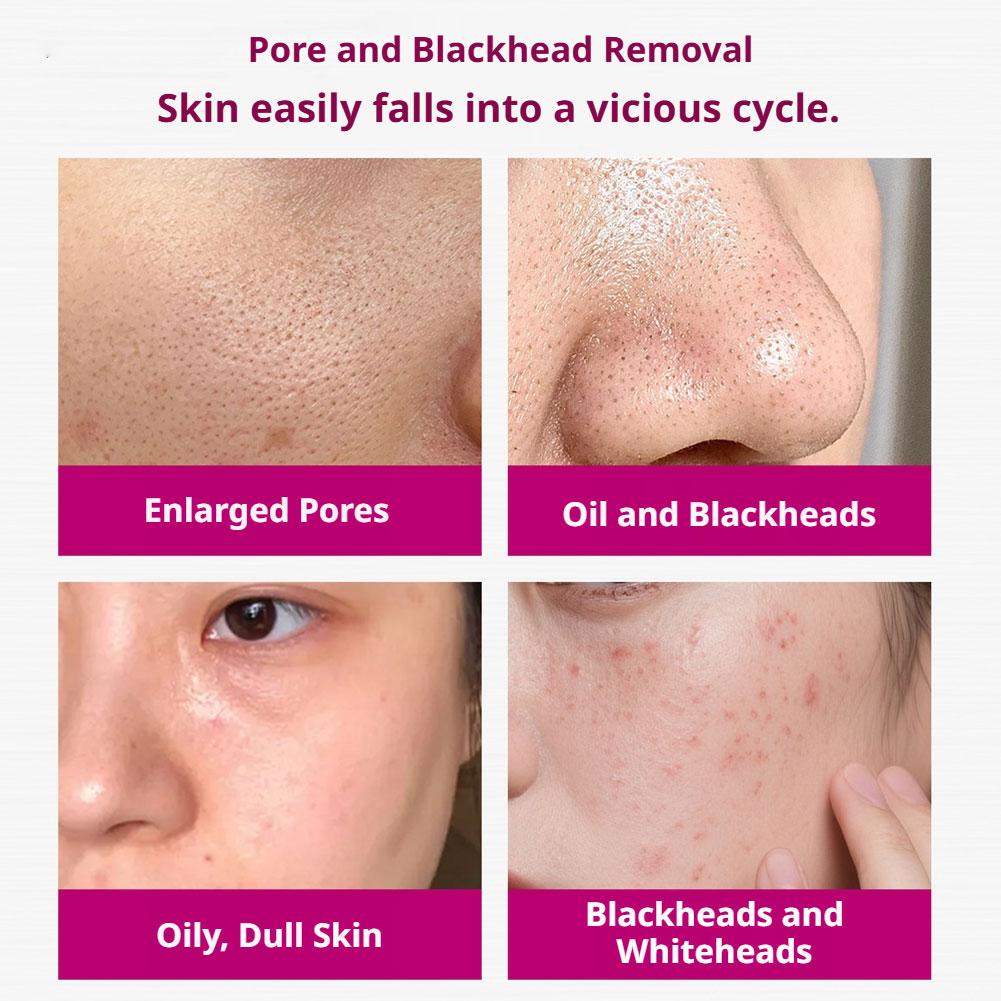 Sérum à l'acide salicylique po - Tranexamic Acid Serum avis et prix