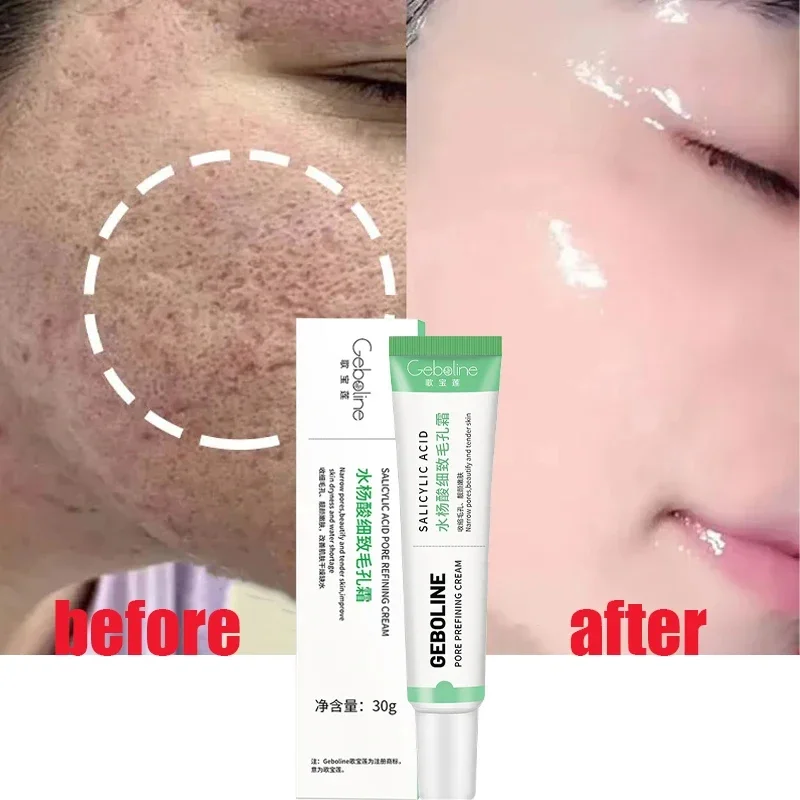 Crème de rétrécissement des po - Skincare Salicylic Acid avis et prix