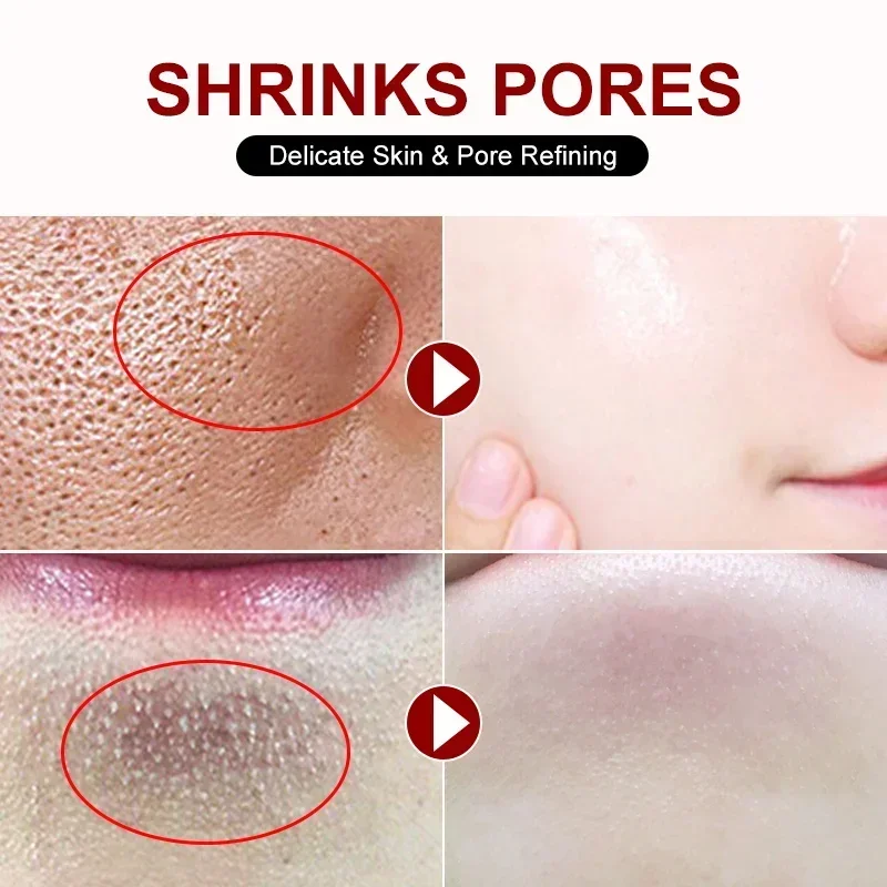 Crème de rétrécissement des po - Skincare Salicylic Acid avis et prix