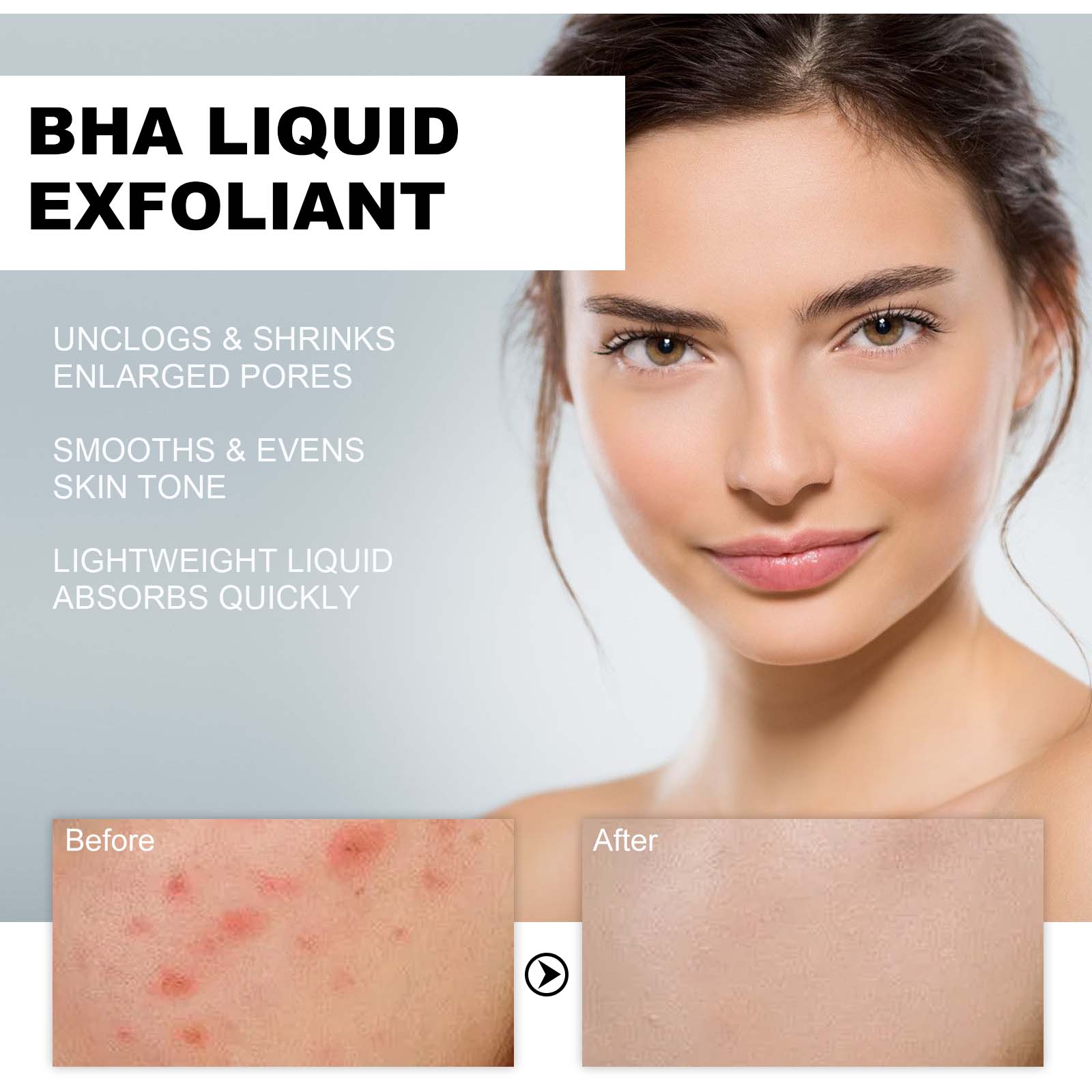 Sérum Exfoliant Liquide à 2% d - Tranexamic Acid Serum avis et prix