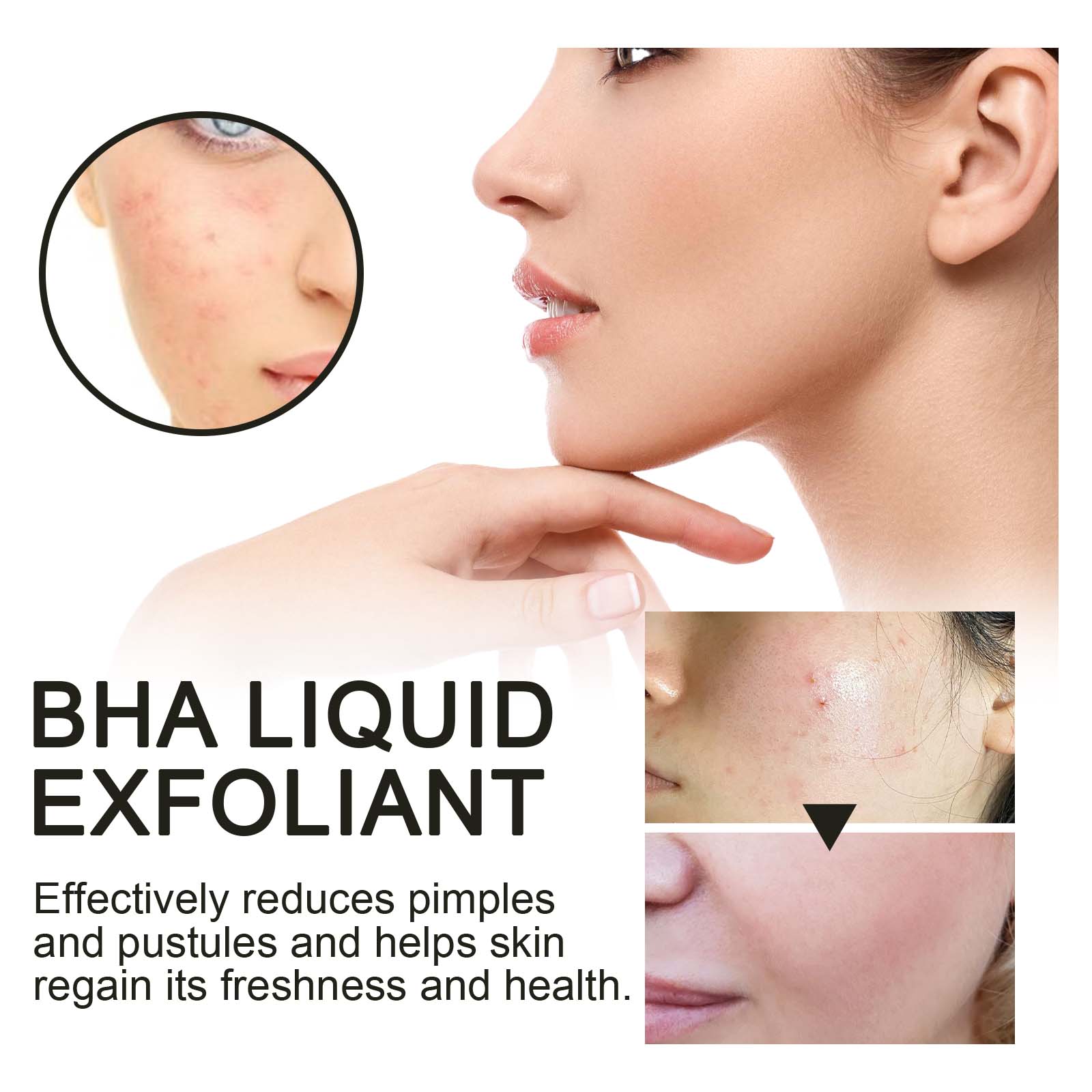 Sérum Exfoliant Liquide à 2% d - Tranexamic Acid Serum avis et prix