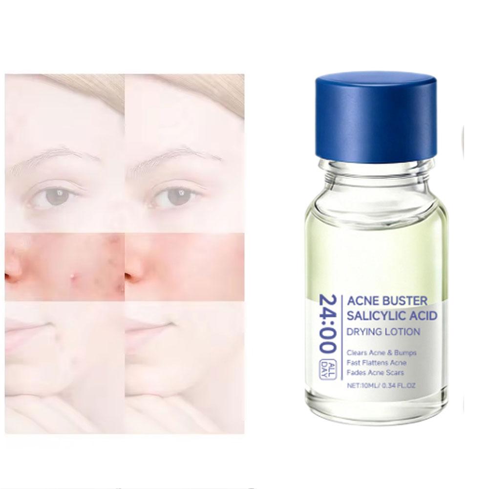 Lotion Traitante à l'Acide Sal - Tranexamic Acid Serum avis et prix