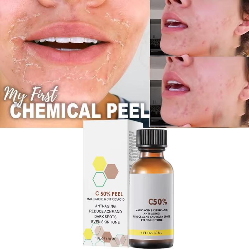 Avec acide malique et acide ci - Tranexamic Acid Serum avis et prix
