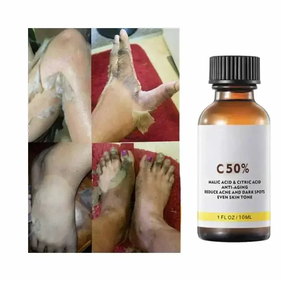 Avec acide malique et acide ci - Tranexamic Acid Serum avis et prix